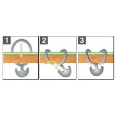 Elastic Fixation Tie (Anchor Gum)